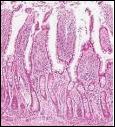 Incretin Hormones